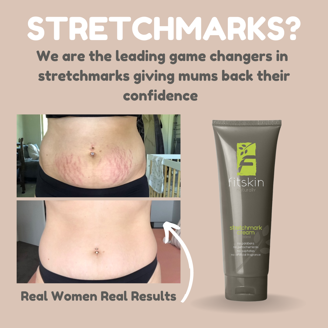 Stretchmark Cream Triple Deal